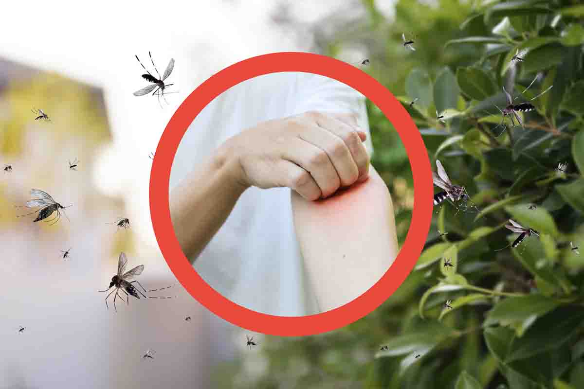 Rimedi naturali alle punture delle zanzare